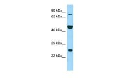 PADI6 Rabbit anti-Human, Polyclonal, Novus Biologicals 0.1 mL | Buy Online | Novus Biologicals | Fisher Scientific